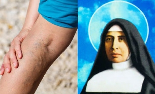Testemunho de uma cura pela intercesso de Santa Paulina : Curei minha perna com a intercesso de Santa Paulina